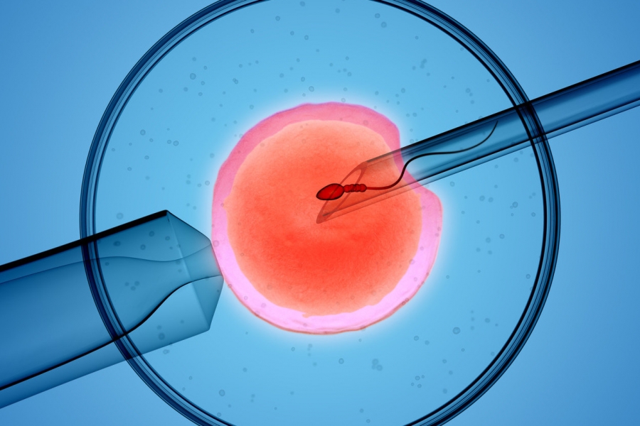 Tüp Bebek Tedavisi (IVF)