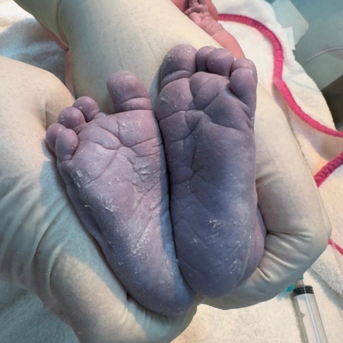 Prof. Dr. Zehra Nihal Dolgun Altıntaş - Edirne Tüp Bebek Merkezi -- Mutluluk Tablosu